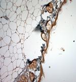 Collagen VII Antibody in Immunohistochemistry (Paraffin) (IHC (P))