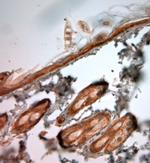 Collagen VII Antibody in Immunohistochemistry (Paraffin) (IHC (P))