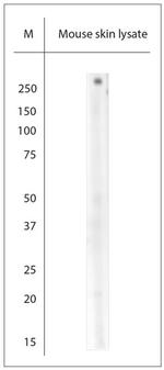Collagen VII Antibody in Western Blot (WB)