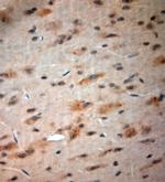 CACNA2D1 Antibody in Immunohistochemistry (Paraffin) (IHC (P))