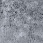 DFNA5 Antibody in Immunohistochemistry (IHC)