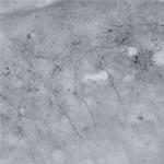 DFNA5 Antibody in Immunohistochemistry (IHC)