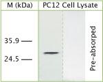 DRAM Antibody in Western Blot (WB)