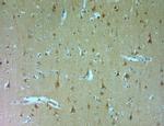 DRAM Antibody in Immunohistochemistry (Paraffin) (IHC (P))
