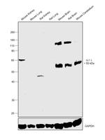 GLT-1 Antibody in Western Blot (WB)