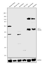 GLT-1 Antibody in Western Blot (WB)