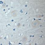 GABARAP Antibody in Immunohistochemistry (Paraffin) (IHC (P))