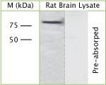 GGA3 Antibody in Western Blot (WB)
