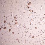 GLUR6 Antibody in Immunohistochemistry (Paraffin) (IHC (P))