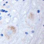 GRIK5 Antibody in Immunohistochemistry (Paraffin) (IHC (P))