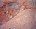 GAD65, 67 Antibody in Immunohistochemistry (Paraffin) (IHC (P))
