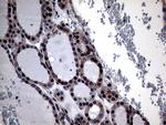 OSGIN2 Antibody in Immunohistochemistry (Paraffin) (IHC (P))