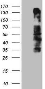 OSGIN2 Antibody in Western Blot (WB)