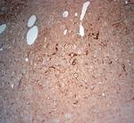 HOMER3 Antibody in Immunohistochemistry (Paraffin) (IHC (P))