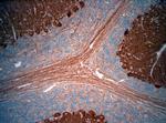 HOMER3 Antibody in Immunohistochemistry (Paraffin) (IHC (P))