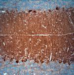 HOMER3 Antibody in Immunohistochemistry (Paraffin) (IHC (P))