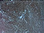 HIF1 alpha Antibody in Immunohistochemistry (Paraffin) (IHC (P))