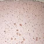 Lamp1 Antibody in Immunohistochemistry (Paraffin) (IHC (P))