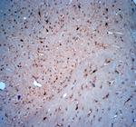 LIMD2 Antibody in Immunohistochemistry (Paraffin) (IHC (P))