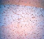 LIMD2 Antibody in Immunohistochemistry (Paraffin) (IHC (P))