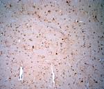 LIMD2 Antibody in Immunohistochemistry (Paraffin) (IHC (P))