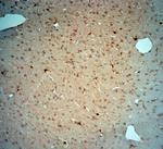 LIMD2 Antibody in Immunohistochemistry (Paraffin) (IHC (P))