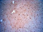 LIMD2 Antibody in Immunohistochemistry (Paraffin) (IHC (P))