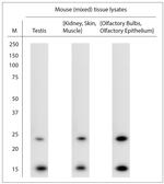LIMD2 Antibody in Western Blot (WB)