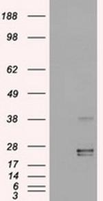 OSM Antibody in Western Blot (WB)