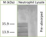 MAP1LC3A Antibody in Western Blot (WB)
