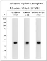 M6PR Antibody in Western Blot (WB)