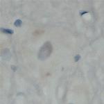 MAL2 Antibody in Immunohistochemistry (Paraffin) (IHC (P))