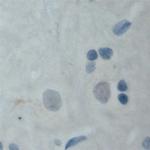 MAL2 Antibody in Immunohistochemistry (Paraffin) (IHC (P))