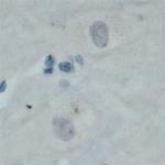 MAL2 Antibody in Immunohistochemistry (Paraffin) (IHC (P))