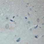 MAL2 Antibody in Immunohistochemistry (Paraffin) (IHC (P))