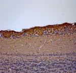 OMP Antibody in Immunohistochemistry (Paraffin) (IHC (P))