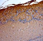 OMP Antibody in Immunohistochemistry (Paraffin) (IHC (P))