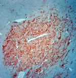 MAP2 Antibody in Immunohistochemistry (Paraffin) (IHC (P))