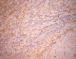 NG2 Antibody in Immunohistochemistry (Paraffin) (IHC (P))