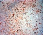 NG2 Antibody in Immunohistochemistry (Paraffin) (IHC (P))