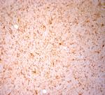 NG2 Antibody in Immunohistochemistry (Paraffin) (IHC (P))