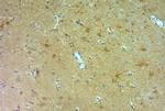 NMDAR3A Antibody in Immunohistochemistry (Paraffin) (IHC (P))