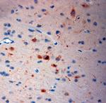 Neurokinin 1 Receptor Antibody in Immunohistochemistry (Paraffin) (IHC (P))