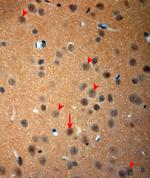 NGF Antibody in Immunohistochemistry (Paraffin) (IHC (P))