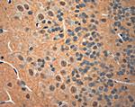 NGF Antibody in Immunohistochemistry (Paraffin) (IHC (P))