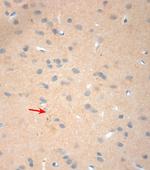 NGF Antibody in Immunohistochemistry (Paraffin) (IHC (P))