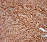 200 Neurofilament Antibody in Immunohistochemistry (Paraffin) (IHC (P))