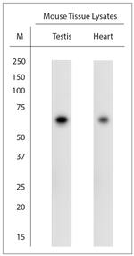 Optineurin Antibody in Western Blot (WB)