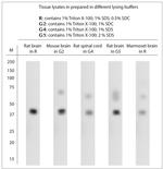 Pejvakin Antibody in Western Blot (WB)