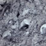 P2RX6 Antibody in Immunohistochemistry - Free Floating (IHC (Free))